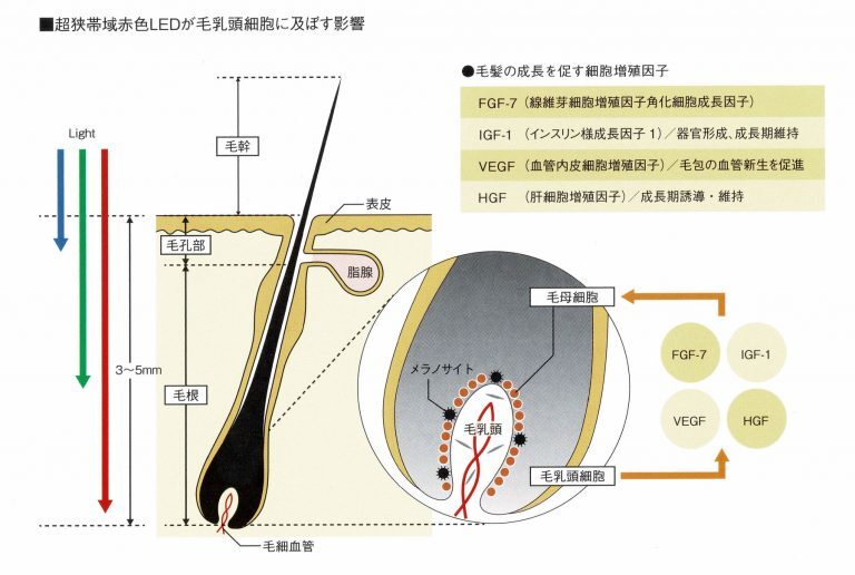超狭帯域赤色LEDが毛乳頭細胞に及ぼす影響