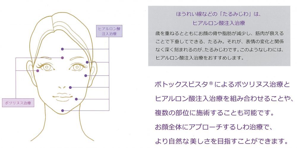 ヒアルロン酸注入治療について